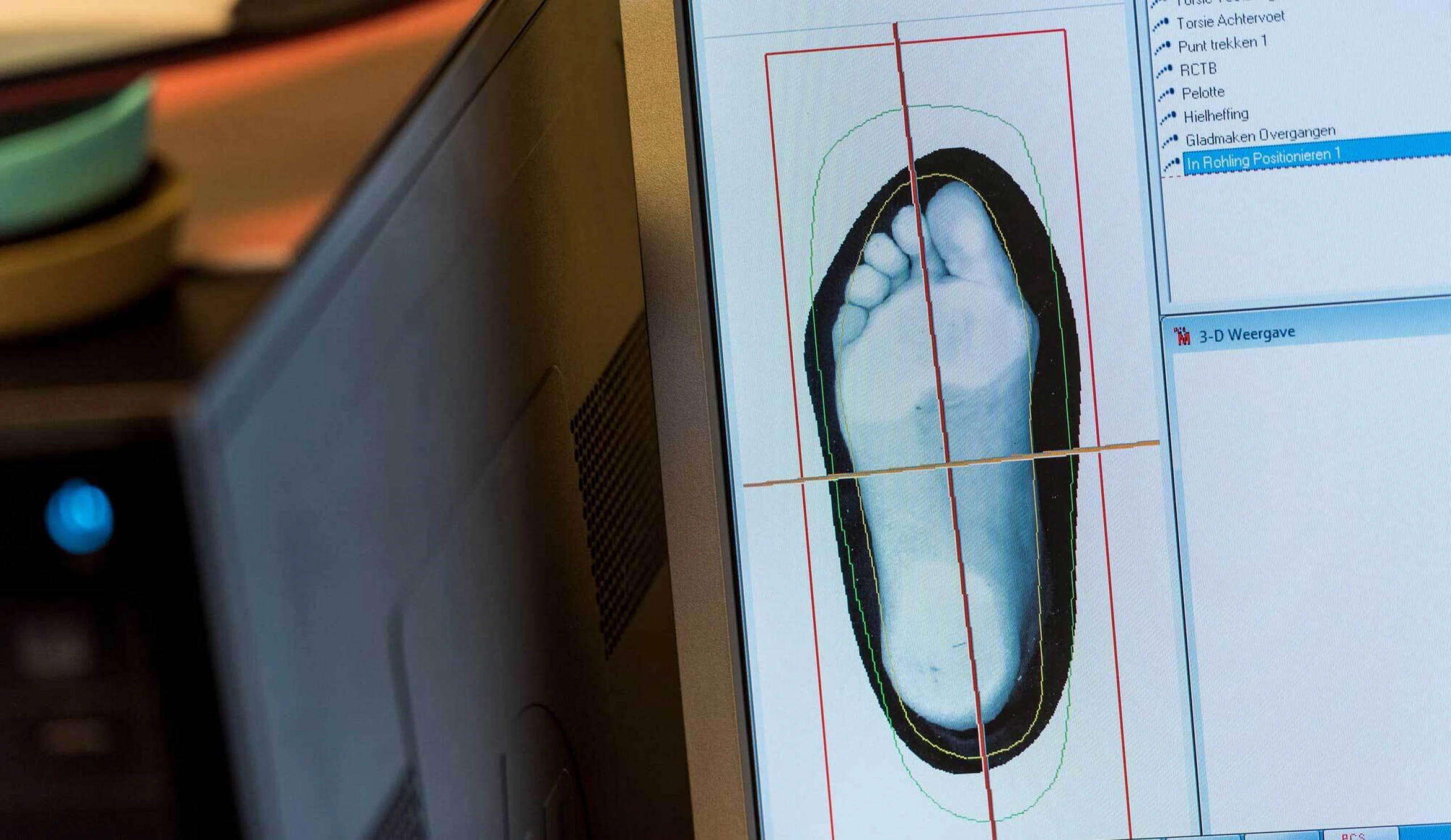 Pijn door zenuwbeklemming voorvoet